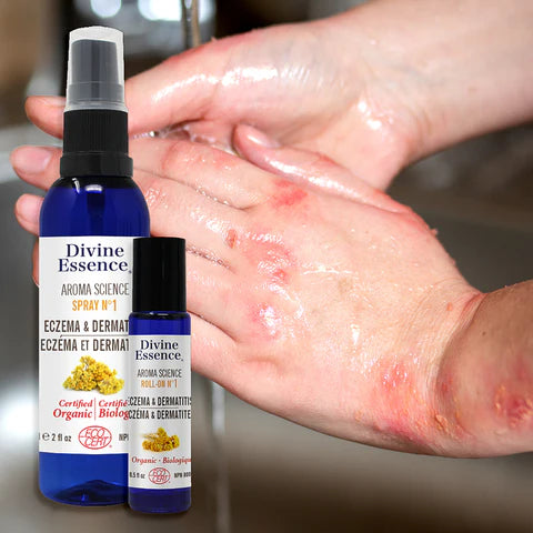 Divine Essence Eczema & Dermatitis Spray